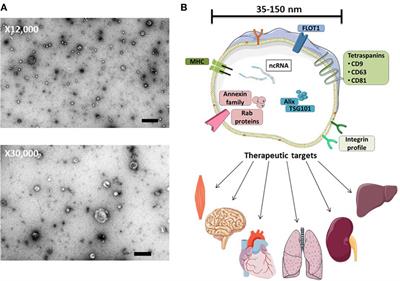 Toward Exosome-Based Therapeutics: Isolation, Heterogeneity, and Fit-for-Purpose Potency